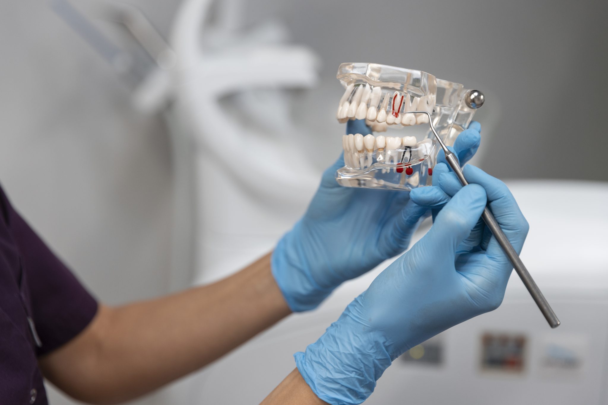 Endodontologie (Wortelkanaalbehandeling)